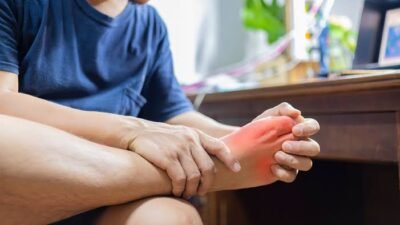 Catat! Minuman Ampuh untuk Turunkan Asam Urat