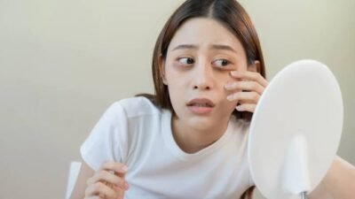 Tips Ampuh Hilangkan Mata Panda Membandel!