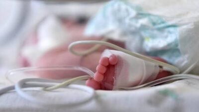 Waduh! Bayi 19 Bulan di Malaysia Terkena Kanker Ovarium Stadium 3, Kok Bisa?