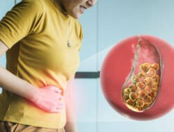 Tipu Daya Dibalik Nikmatnya Makanan Ini, Ternyata bisa Sebabkan Batu Empedu!