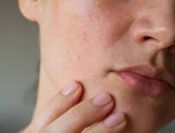 Stop Skincaremu, Jika Mengalami Tanda Seperti Ini Pada Kulit!
