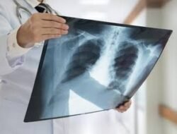 Waspada Penumpukan Lendir di Paru-paru, Ini Bahayanya!