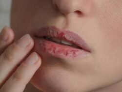 Mau Kulit Tetap Segar dan Glowing Selama Puasa? Simak Tipsnya Ya!