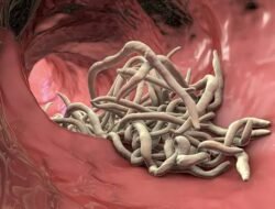 Waspada! Ini ciri-ciri Ada Cacing dalam Tubuh