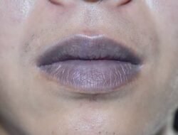 Bibir Kamu Gelap? Coba Cara Ini untuk Mencerahkan nya Yuk!