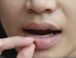Ketahui! Ciri Diabetes Ringan yang Jarang Disadari